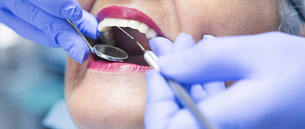 Best Emergency Care for Gum Disease in USA